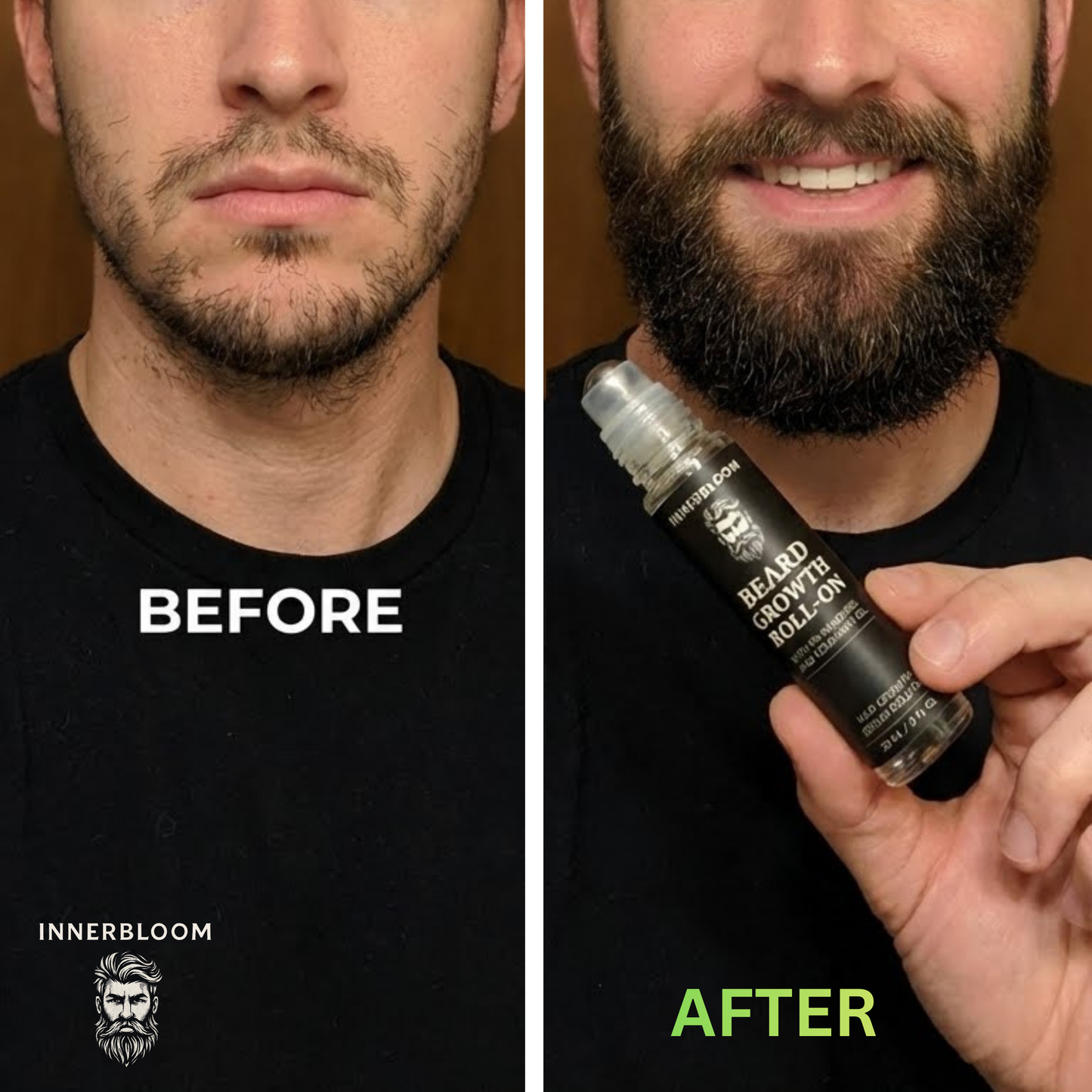 Innerbloom™ Beard Growth Roller with 5% Minoxidil & Rosemary Oil (Pack of 2)